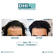 Get guaranteed results with DHI Chandigarh