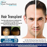 Best Hair Transplant Surgery at Affordable Cost in Delhi NCR, India