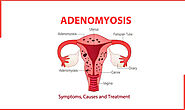 Adenomyosis : Symptoms, Causes And Treatment | Indira IVF