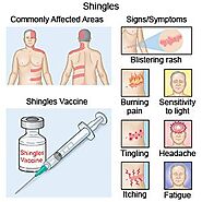Website at https://philaholisticclinic.com/treatment-for-shingles/