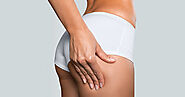 Brazilian Butt lift Surgery | Dr Priya Bansal