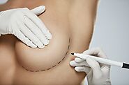 Breast Augmentation - Knowing the Right Size