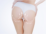 Safest Method for Brazilian Butt lift Surgery