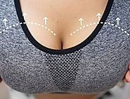 The Ultimate Guide to Breast Reduction Surgery