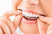 Get Straight Teeth With Invisalign Braces by Epping Dentist