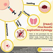 Du you know about Fine Needle Aspiration Cytology Procedure?- Dr Panchal Lab and Diagnostic Centre, Pathology Lab in ...
