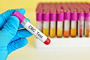 CBC Test- Complete Blood Count- Dr Panchal Lab, Diagnostic Centre in Borivali