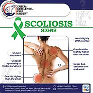 Do you know about these 𝐒𝐜𝐨𝐥𝐢𝐨𝐬𝐢𝐬 signs?- CESS - Center of Excellence in Spine Surgery, Spine Surgeon in Mumbai