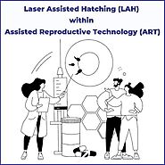 Laser Assisted Hatching (LAH) with in Assisted Reproductive Technology (ART) - Sno | Restaurant in St. Louis, MO