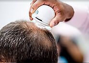 DHI Offers The Best Hair Transplant in Bangalore | DHI India