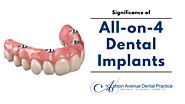 Significance of All-on-4 Dental Implants | Claremont Dental Blog