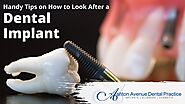 Tips to Look After a Dental Implant from Home | Claremont Dental Blog