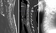 Differences & Similarities Between X-Ray, CT scan and MRI | MDRC India