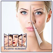 Plastic Surgery: Going Under the Knife
