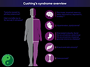 Treatment for Cushing's Syndrome - Philadelphia Acupuncture Clinic
