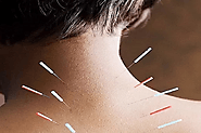Treatment for Neck Pain | Philadelphia Acupuncture Clinic | Dr. Tsan & Co