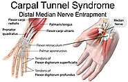 Treatment for Carpal Tunnel Syndrome - Philadelphia Acupuncture Clinic