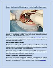 Know the Impact of Smoking on Dental Implant Procedure by Ezcadlab - Issuu