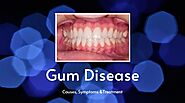 Gum Disease: Causes, Symptoms and Treatment