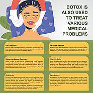Botox is Also Used to treat various medical Problems