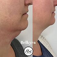 Belkyra before and after - Flirt. Cosmetics Studio