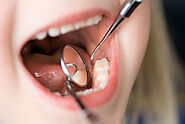 Cavity? Now What? Here is What Dentist Recommend When Cavities