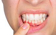 How Periodontal Disease Can Effect The Oral Health