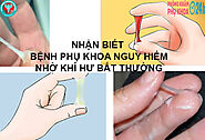 NHẬN BIẾT BỆNH PHỤ KHOA NGUY HIỂM NHỜ KHÍ HƯ BẤT THƯỜNG!