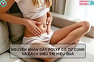 NGUYÊN NHÂN GÂY POLYP CỔ TỬ CUNG VÀ CÁCH ĐIỀU TRỊ HIỆU QUẢ