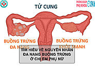 TÌM HIỂU VỀ NGUYÊN NHÂN ĐA NANG BUỒNG TRỨNG Ở CHỊ EM PHỤ NỮ