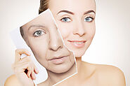 Find the best Anti Ageing Treatment in Arnos Grove