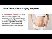 All You Need to Know About Tummy Tuck Surgery