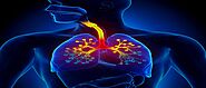 Bronchitis Treatment and Causes - Holistic Health Practitioner's File