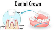 The Complete Guide to Cosmetic Dental Treatments and What to Expect Before & After