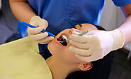 What You Need to Know About Dental Crowns, Root Canal Specialists, and Finding the Best Cosmetic Dentist