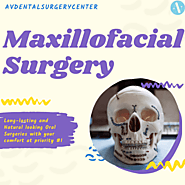 Best Maxillofacial Surgery Procedures | AV Dental