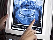 Australia Dental X-Ray Market Size, Share, Trend & Forecast 2026 | TechSci Research