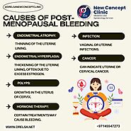 What Are the Causes of Post-Menopausal Bleeding?