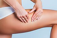 Three tips for cellulite reduction