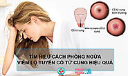 TÌM HIỂU CÁCH PHÒNG NGỪA VIÊM LỘ TUYẾN CỔ TỬ CUNG HIỆU QUẢ!