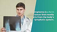 Prevent Lymphoma Cancer In Just Few Steps | Lymphoma Cancer doctor In Noida | Dr. Manish Singhal