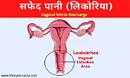 सफेद पानी (लिकोरिया) का घरेलू इलाज – Home remedy for white discharge in Hindi – Lifestyle चाचा