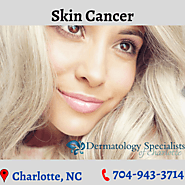 Skin cancer is preventable with sunscreen says top Charlotte dermatologist