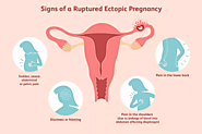 Ectopic Pregnancy? Know about the Symptoms | Signs | Treatment | Complications.