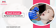 What Are The Symptoms & Procedure Of Root Canal?