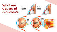 What are The Causes of Glaucoma? - DLEI