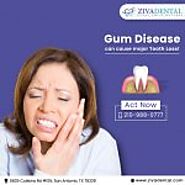 Receding Gum Disease Stages