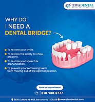 5 Advantages of Dental Bridge Procedure