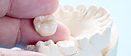 6 Reasons to Choose a Dental Crown