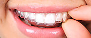 10 Invisalign Tips for the Best Results
